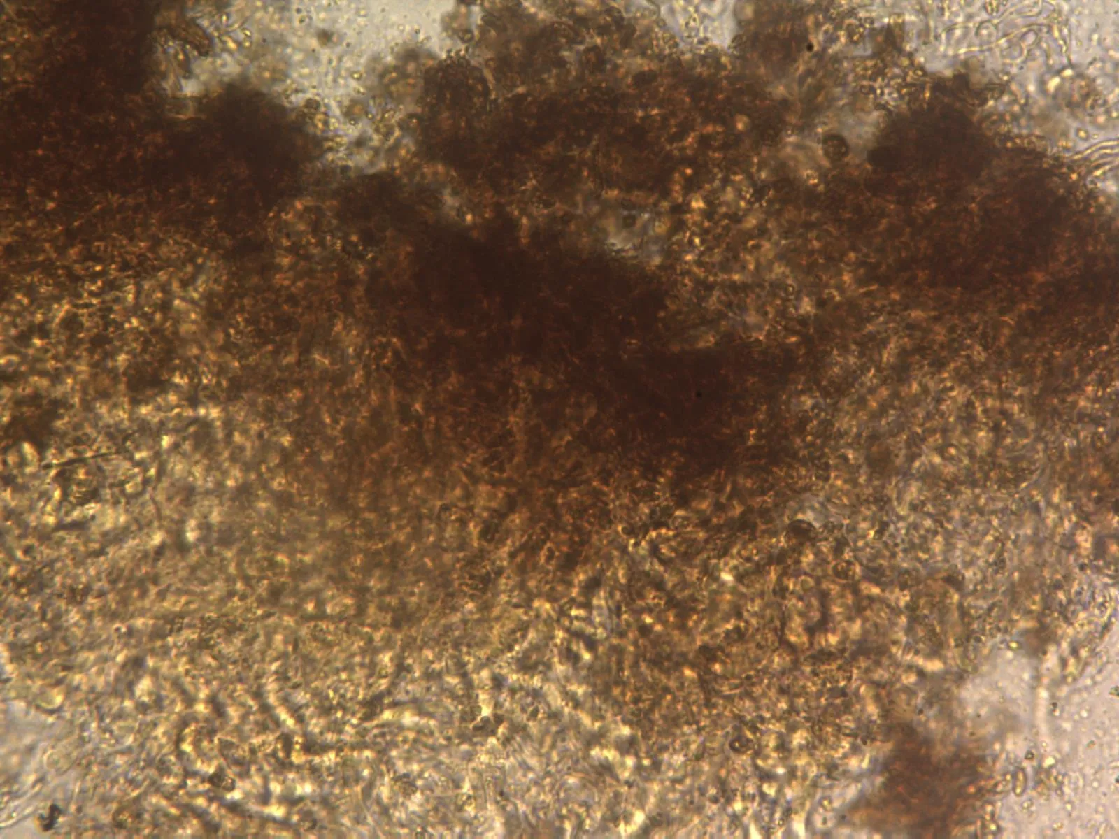 Microscopía de Suillellus queletii - 13 - Cutícula x 400